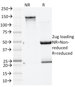 Data from SDS-PAGE analysis of Anti-GAD2 antibody (Clone GAD2/1960). Reducing lane (R) shows heavy and light chain fragments. NR lane shows intact antibody with expected MW of approximately 150 kDa. The data are consistent with a high purity, intact mAb.